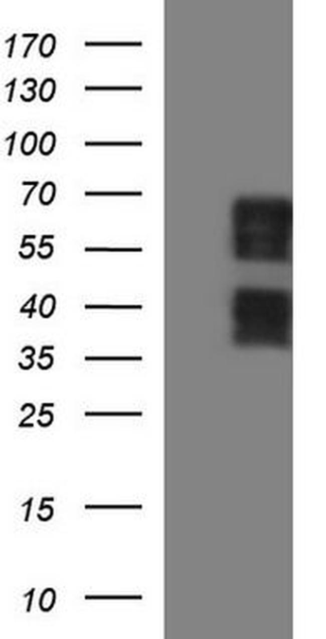 SCHIP1 Antibody in Western Blot (WB)