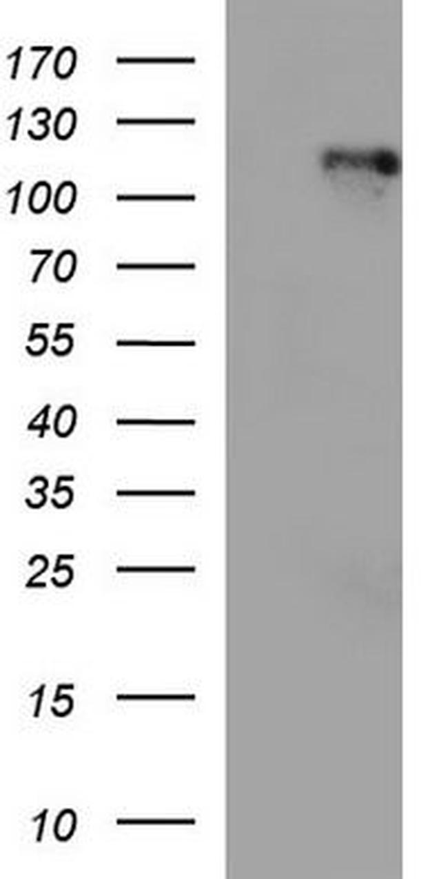 TCIRG1 Antibody in Western Blot (WB)