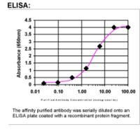 MMP11 Antibody in ELISA (ELISA)