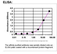 KIFC3 Antibody in ELISA (ELISA)