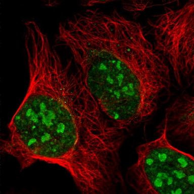 E2F1 Antibody in Immunocytochemistry (ICC/IF)