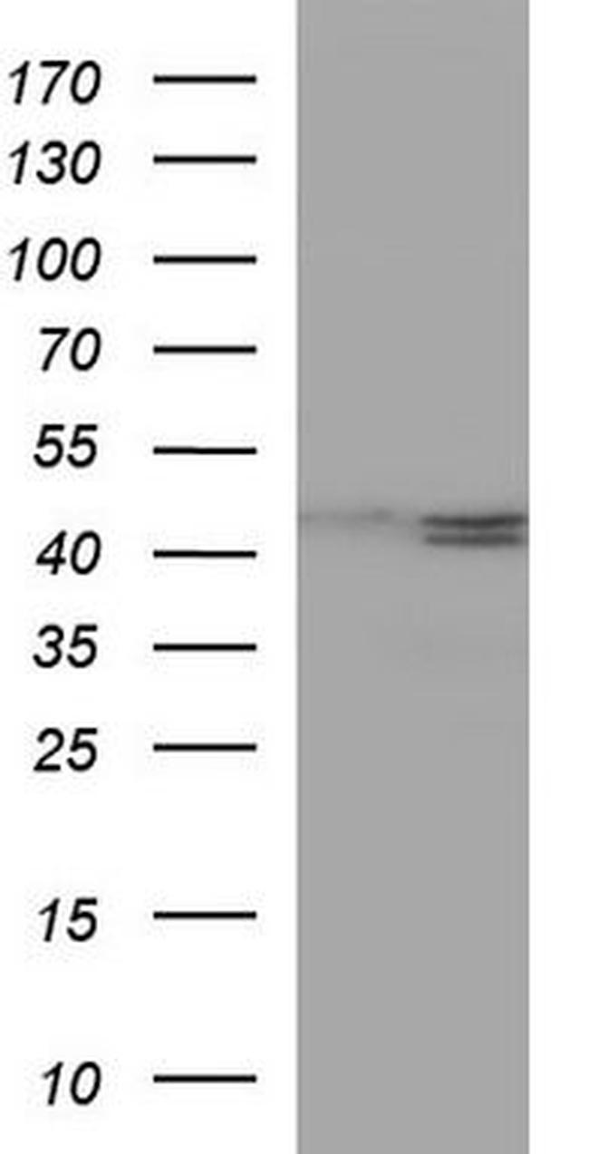 ELK1 Antibody in Western Blot (WB)