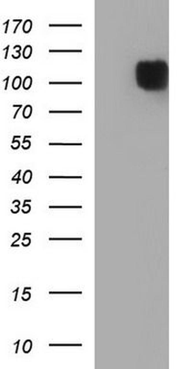 CD62P Antibody in Western Blot (WB)