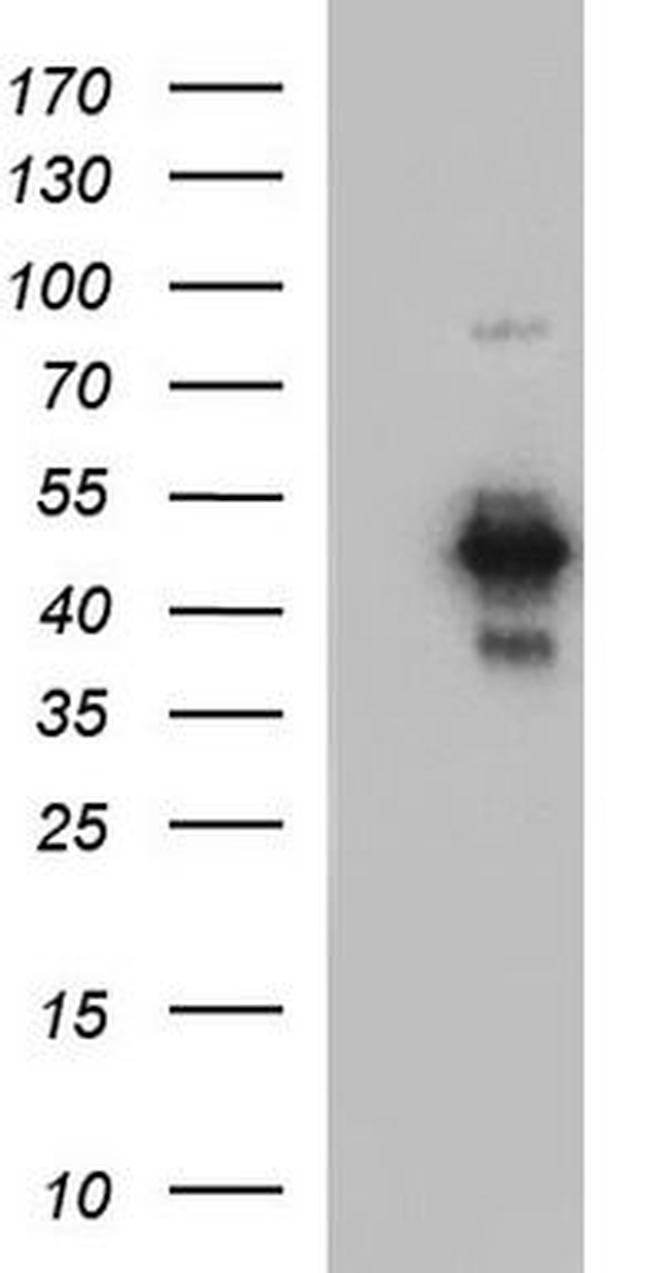 Coxsackie Adenovirus Receptor Antibody in Western Blot (WB)