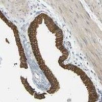 TBC1D8 Antibody in Immunohistochemistry (Paraffin) (IHC (P))