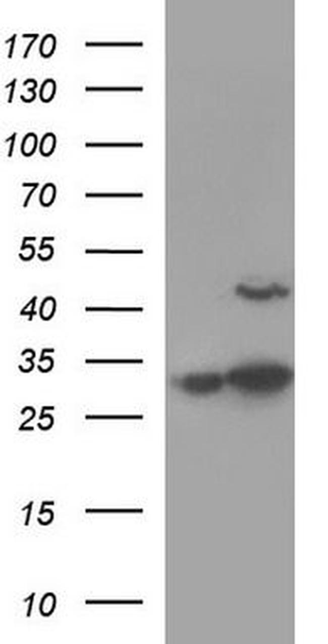 AAMP Antibody in Western Blot (WB)