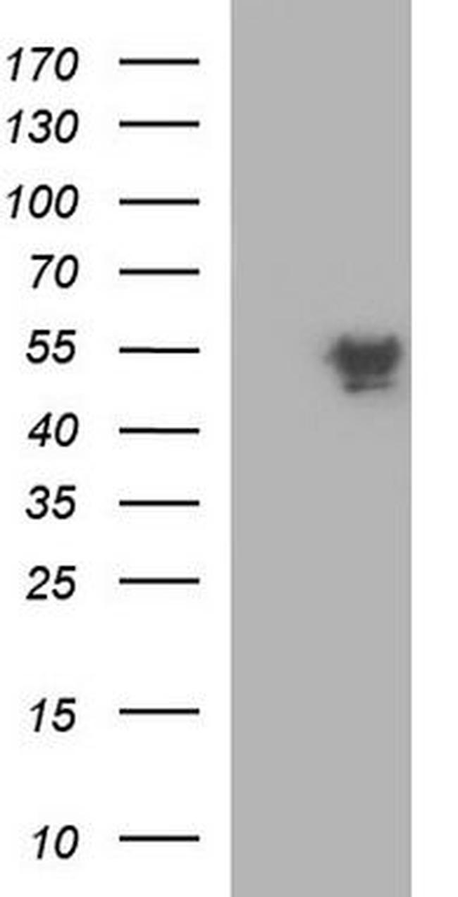 Cleavage Stimulation Factor Antibody in Western Blot (WB)