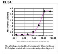 Prolactin Antibody in ELISA (ELISA)