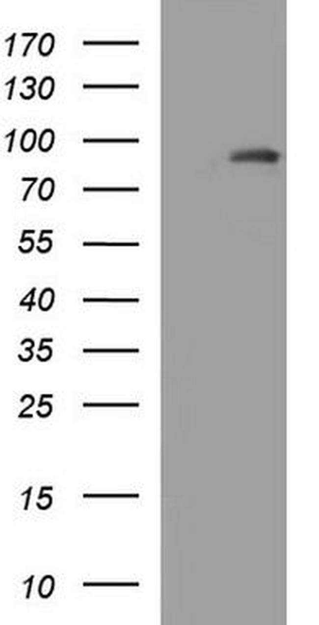 Prolactin Receptor Antibody in Western Blot (WB)