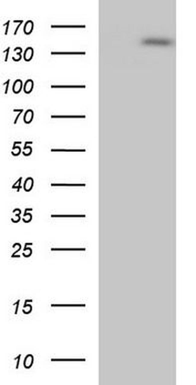 eNOS Antibody in Western Blot (WB)