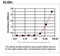 BRCA2 Antibody in ELISA (ELISA)