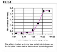 BRCA2 Antibody in ELISA (ELISA)