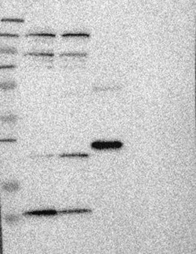 CMC2 Antibody in Western Blot (WB)