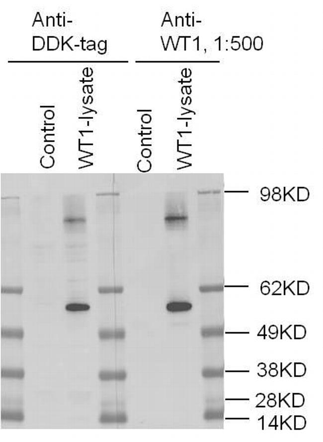 WT1 Antibody in Western Blot (WB)