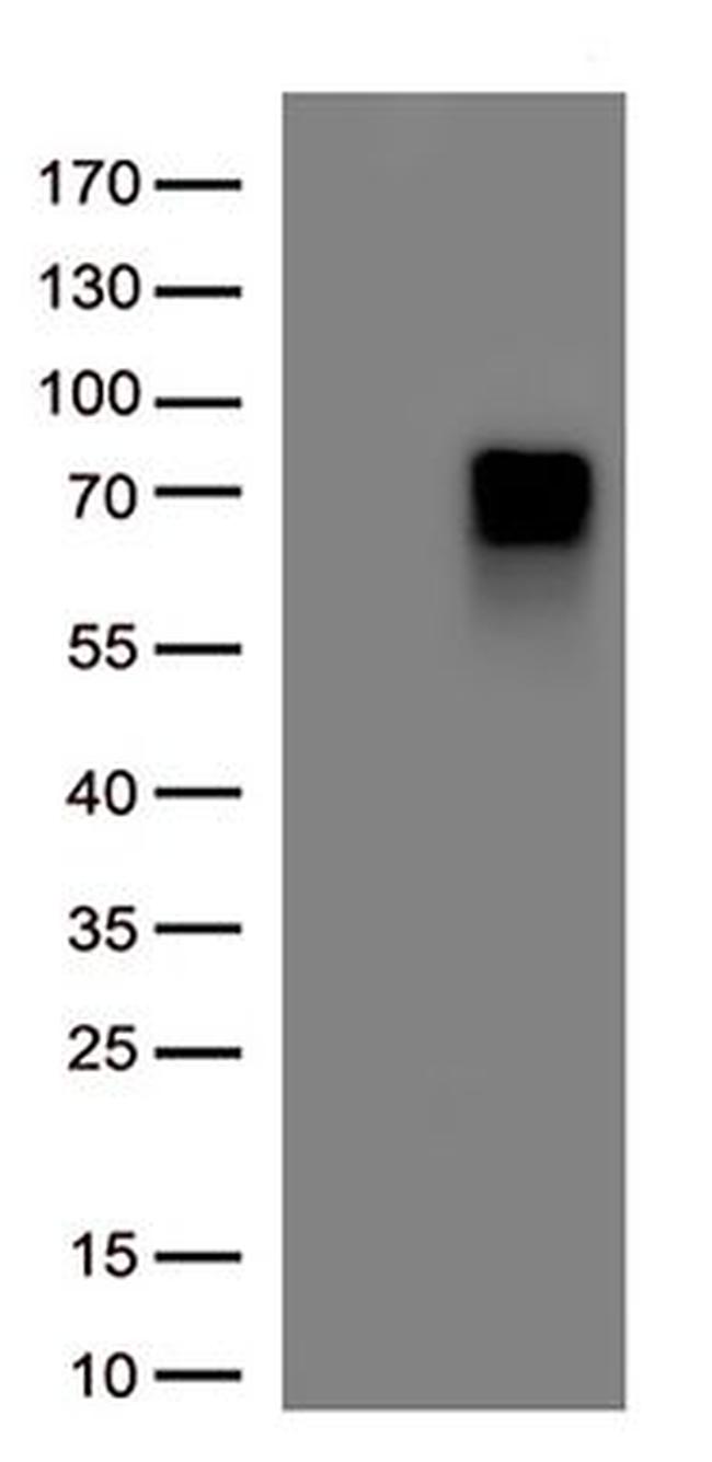 SOX11 Antibody in Western Blot (WB)