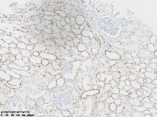 HNF1-Beta (HNF1B) Antibody in Immunohistochemistry (Paraffin) (IHC (P))