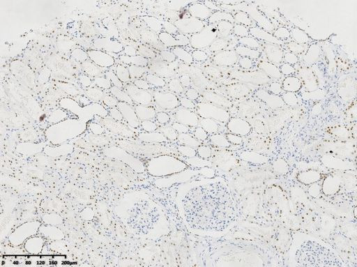 HNF1-Beta (HNF1B) Antibody in Immunohistochemistry (Paraffin) (IHC (P))