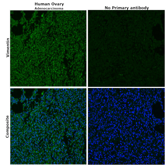 VIM Antibody in Immunohistochemistry (Paraffin) (IHC (P))