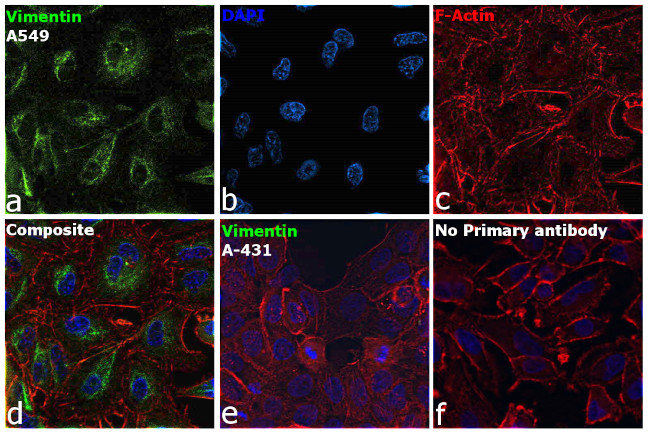 VIM Antibody