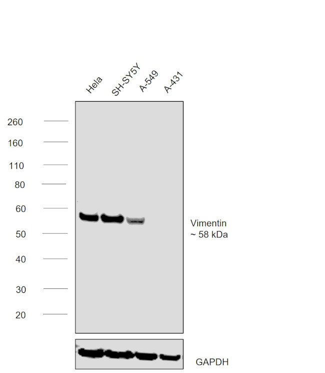 VIM Antibody