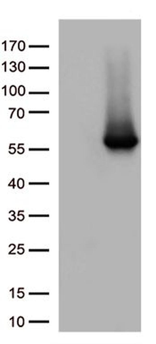 ARRB1 Antibody in Western Blot (WB)