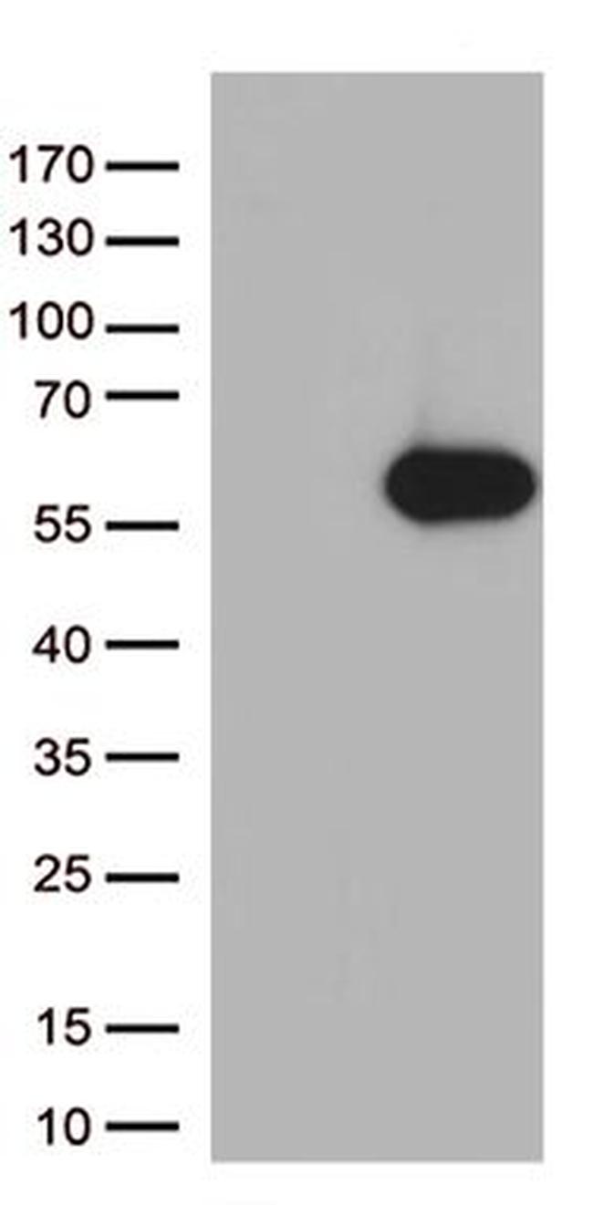 ARRB1 Antibody in Western Blot (WB)