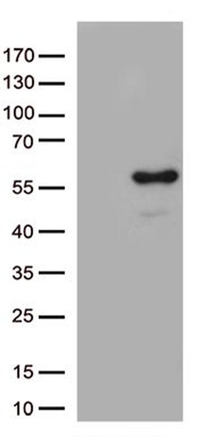 ARRB1 Antibody in Western Blot (WB)