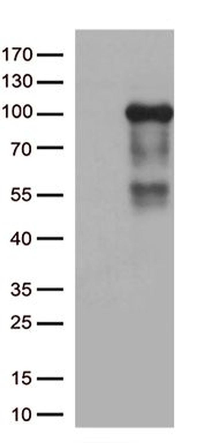 ADAM28 Antibody in Western Blot (WB)