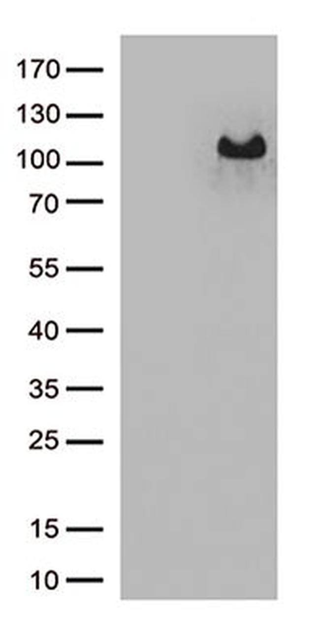 ARHGEF4 Antibody in Western Blot (WB)