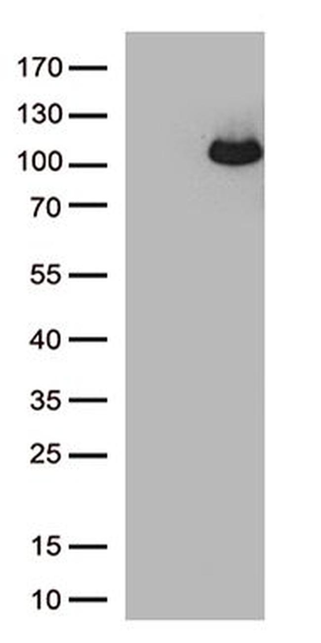 ARHGEF4 Antibody in Western Blot (WB)