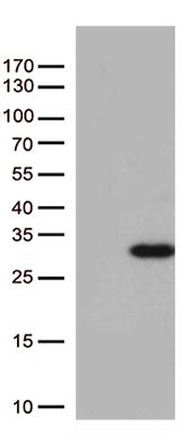 RAB5A Antibody in Western Blot (WB)