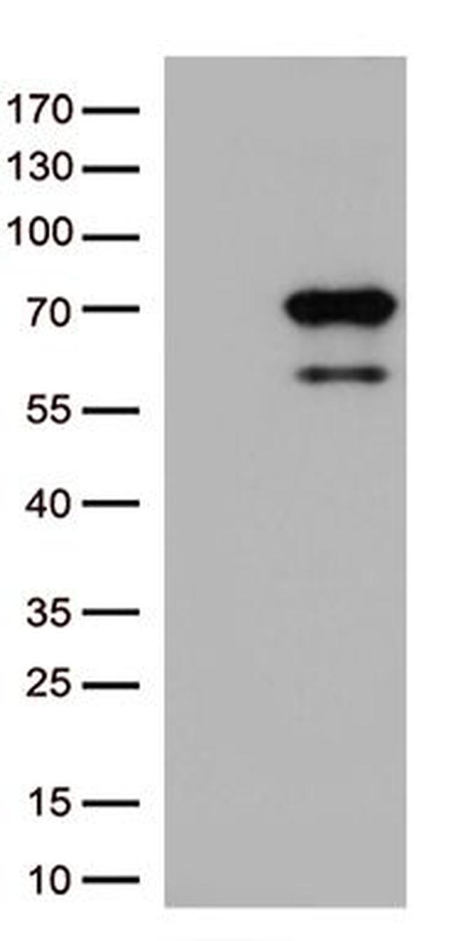 SEPT9 Antibody in Western Blot (WB)