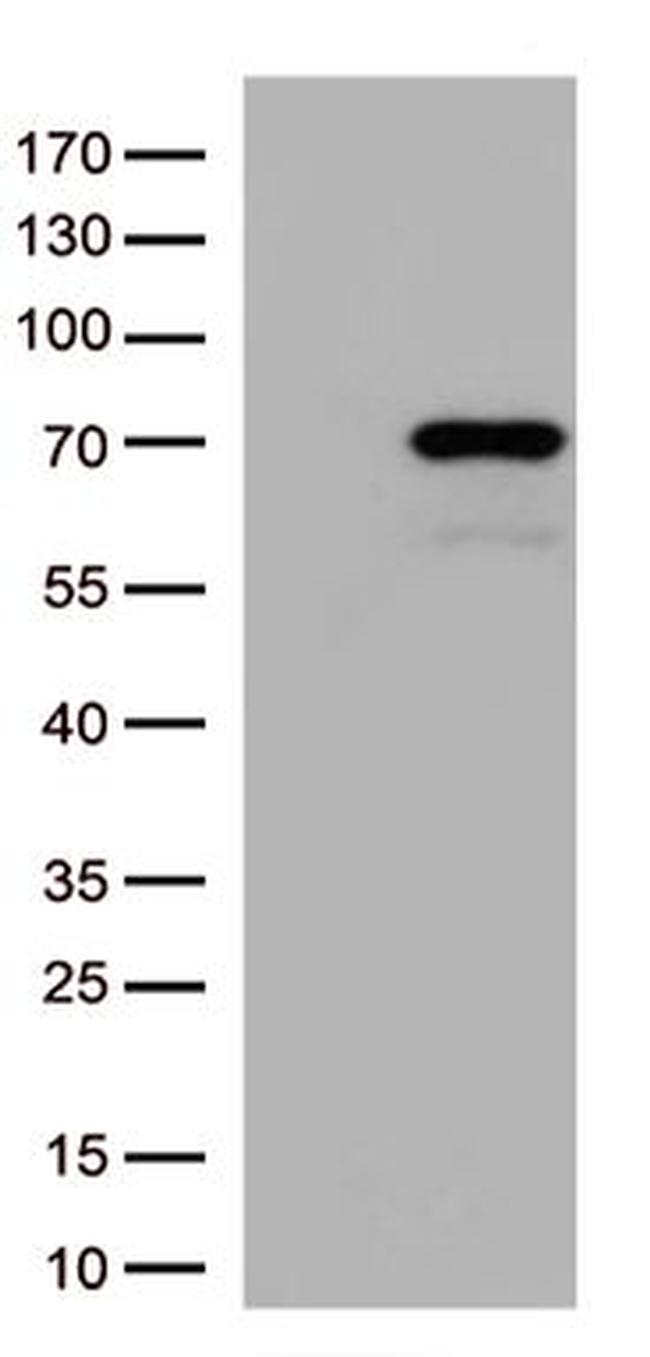 SEPT9 Antibody in Western Blot (WB)