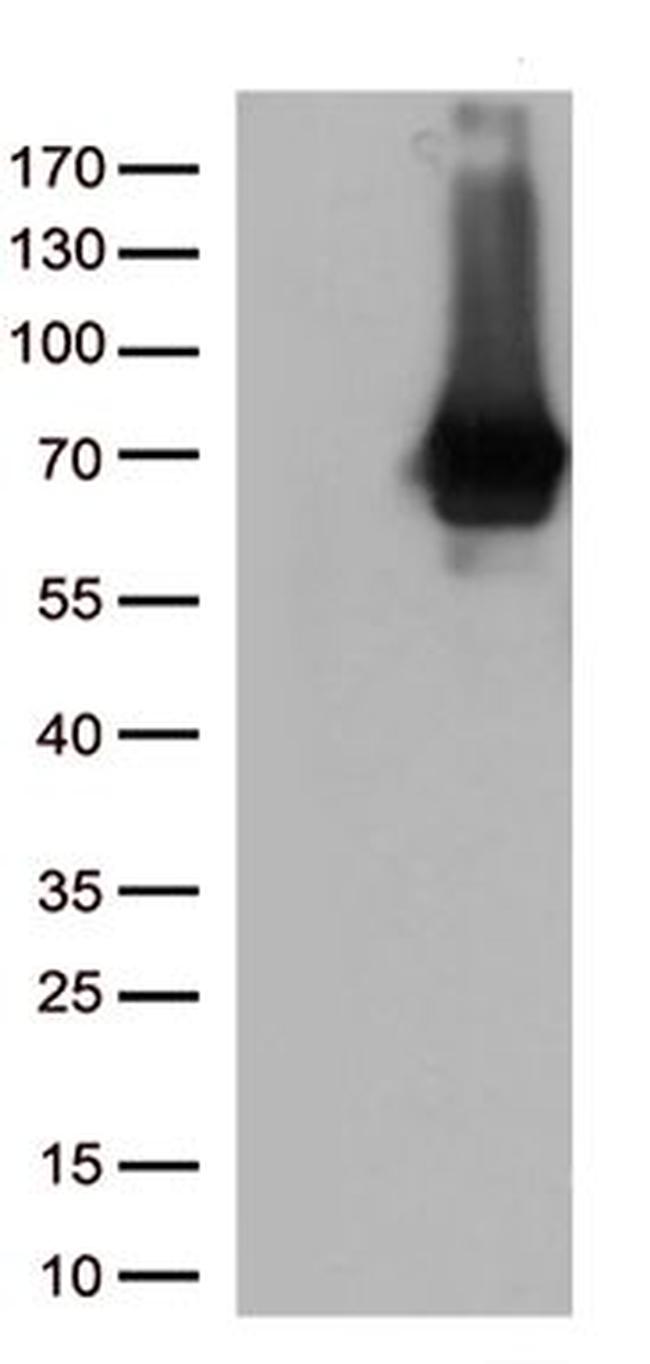 SEPT9 Antibody in Western Blot (WB)