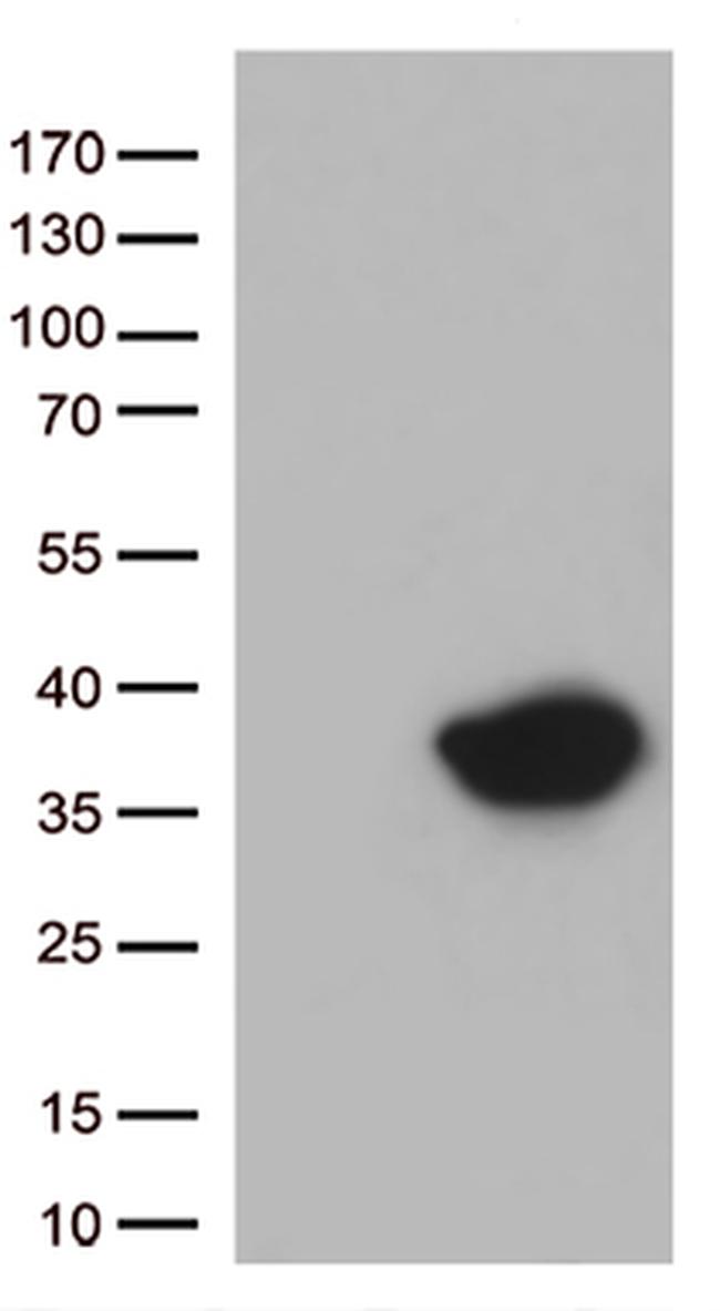 Syntaxin 1a (STX1A) Antibody in Western Blot (WB)