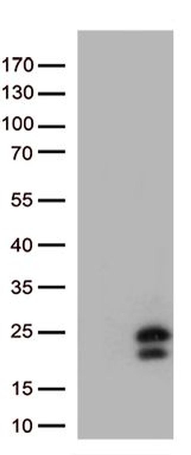 IFNL1 Antibody in Western Blot (WB)