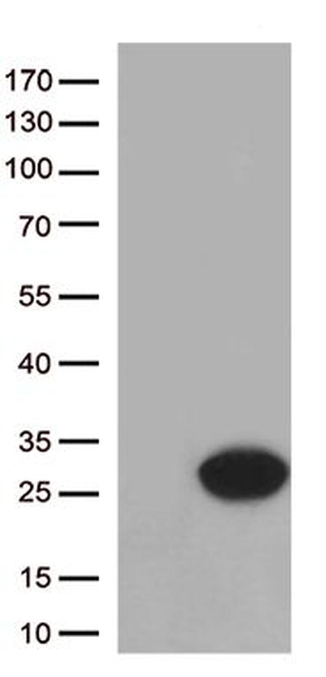 CYGB Antibody in Western Blot (WB)