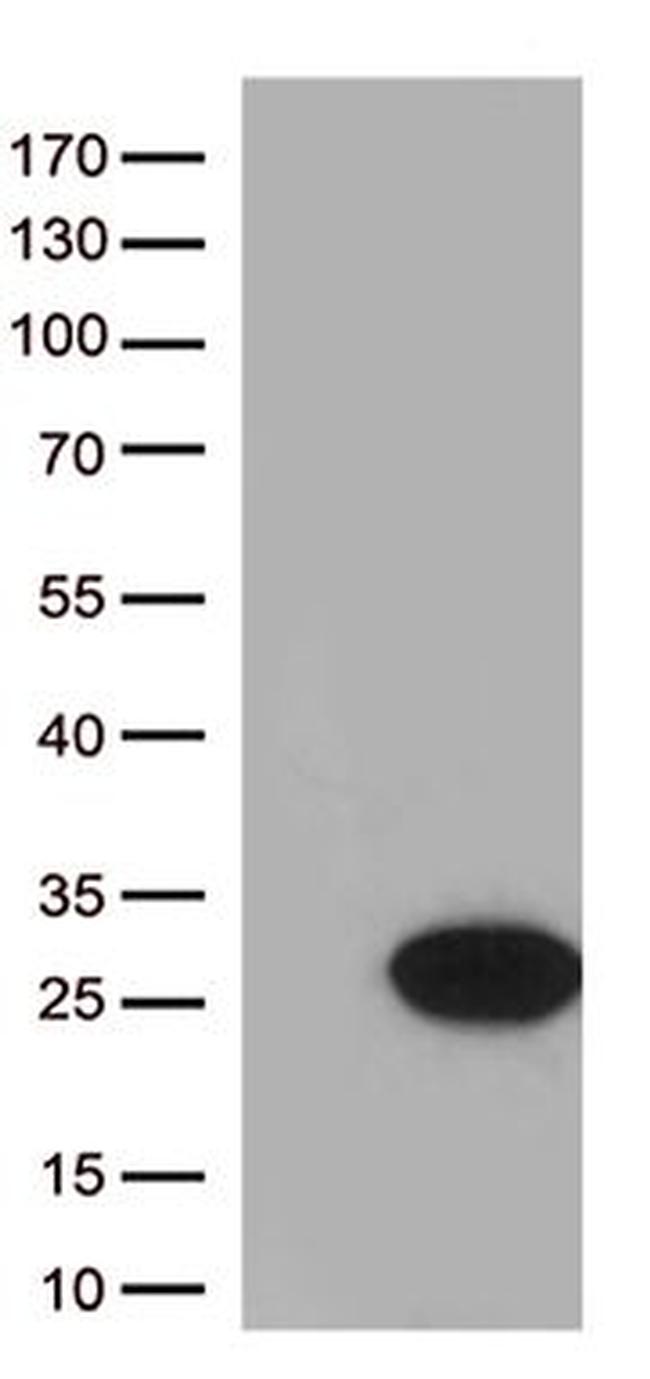 CYGB Antibody in Western Blot (WB)