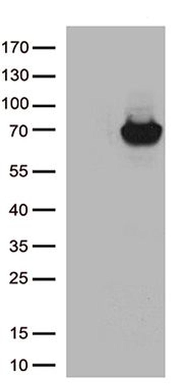 ARSB Antibody in Western Blot (WB)