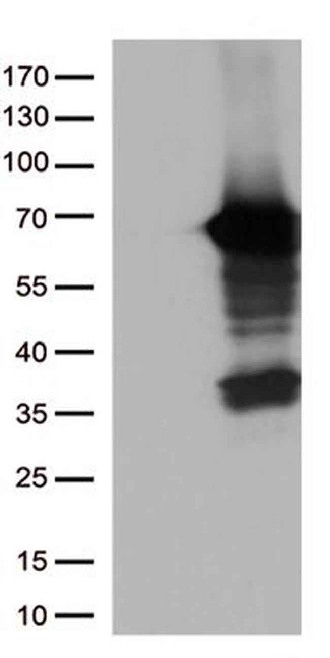 USH1C Antibody in Western Blot (WB)