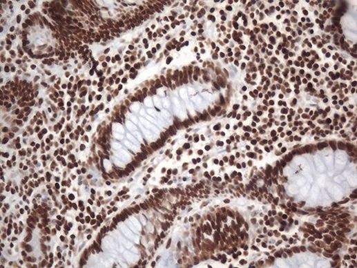 EWSR1 Antibody in Immunohistochemistry (Paraffin) (IHC (P))