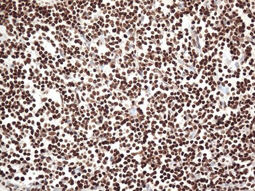 EWSR1 Antibody in Immunohistochemistry (Paraffin) (IHC (P))