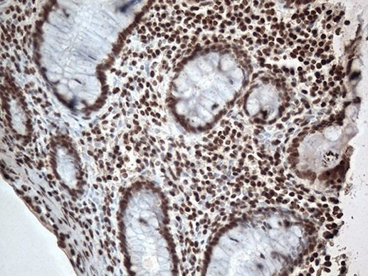 EWSR1 Antibody in Immunohistochemistry (Paraffin) (IHC (P))