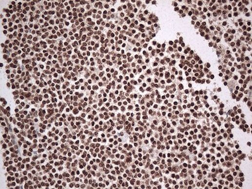 EWSR1 Antibody in Immunohistochemistry (Paraffin) (IHC (P))