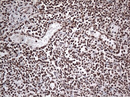 EWSR1 Antibody in Immunohistochemistry (Paraffin) (IHC (P))