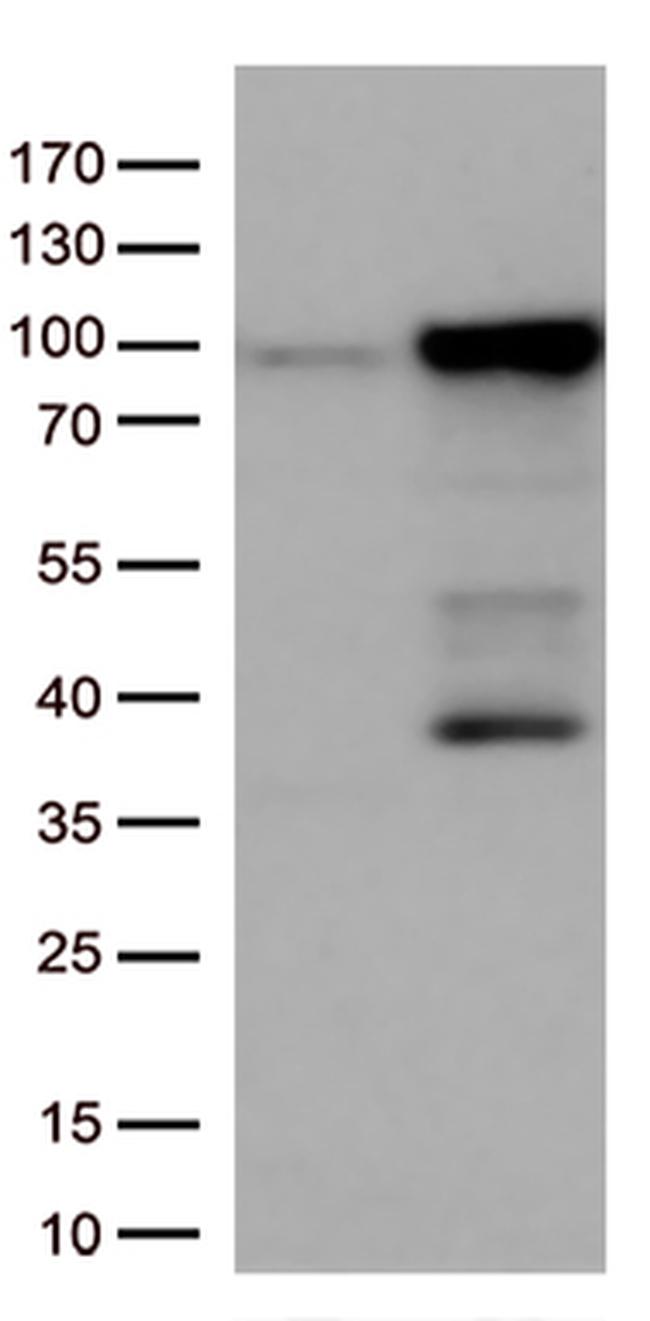 EWSR1 Antibody in Western Blot (WB)