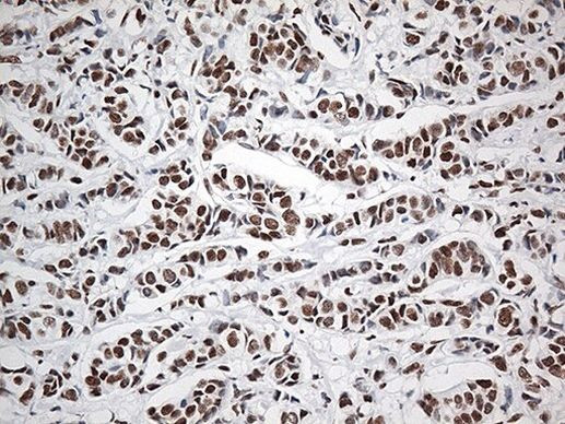 EWSR1 Antibody in Immunohistochemistry (Paraffin) (IHC (P))