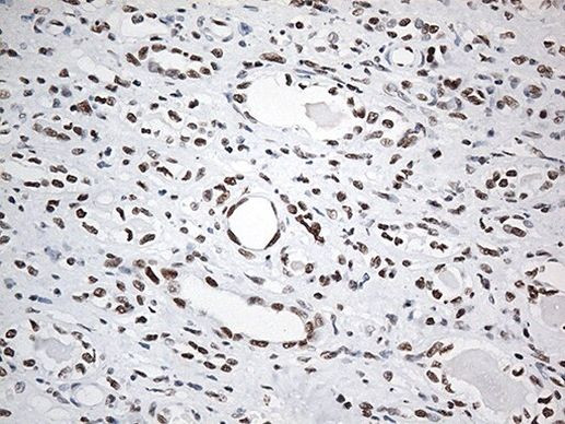 EWSR1 Antibody in Immunohistochemistry (Paraffin) (IHC (P))