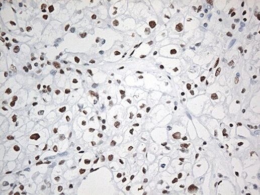 EWSR1 Antibody in Immunohistochemistry (Paraffin) (IHC (P))