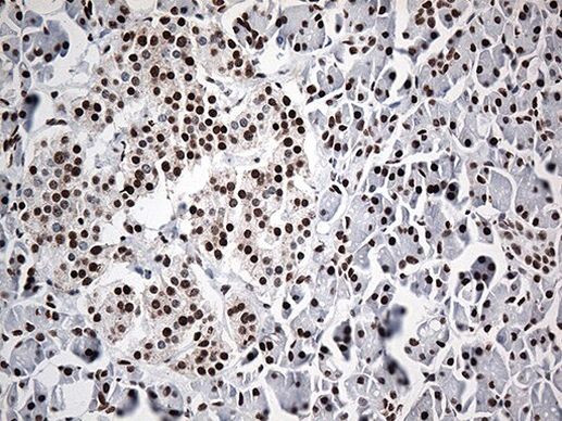 EWSR1 Antibody in Immunohistochemistry (Paraffin) (IHC (P))